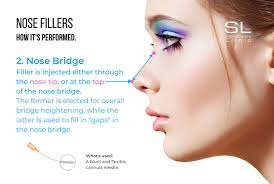 Our team believes permanent fillers are best avoided. Nose Fillers In Singapore Sl Aesthetic Clinic