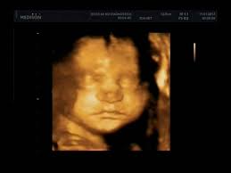 penelope leon (@MicoNoa)