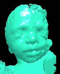 Improving the process of making rapid prototyping models from medical  ultrasound images