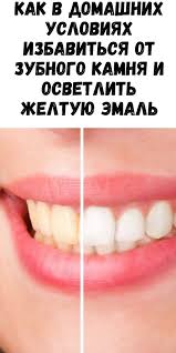 как осветлить волосы в домашних условиях без вреда для волос Pin Na Doske Life Hacks