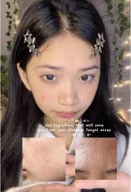 Hygienic Benefits of Spray Toner for Skincare