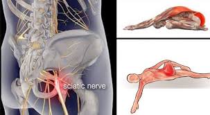 The hip muscles encompass many muscles of the hip and thigh whose main function is to act on iliacus is a large triangular shaped muscle that. 10 Piriformis Stretches To Get Rid Of Sciatica Hip And Lower Back Pain 01 Easy Life