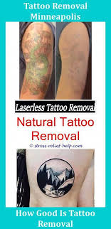 Cheap Tattoo Removal Is It Possible To Remove A Tattoo At Home Tattoo Removal That Works Quanta System Laser Tattoo Removal Tattoos Removal Is There Any Natural