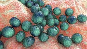 Image result for Staphylococcus Saprophyticus