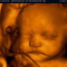 Sonogram Secrets By Trimester Advanced Ultrasound Services