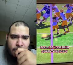 Broken Leg Injury Duke Football