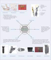 53 Types And Configuration Of Implants Pocket Dentistry