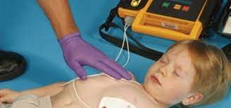 Para la utilización de un desfibrilador externo semiautomático es imprescindible estar formado y autorizado, y conocer a fondo la reanimación cardio. Como Se Usa Un Desfibrilador Externo Automatico Dea Healthychildren Org