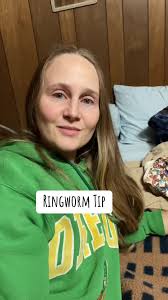Ringworm isn’t any fun, but here’s a fun little trick my vet told me about.  #ringworm #ringwormtreatment #petcare #animallover