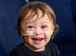 Little boy Down's Syndrome and breathing condition models for Primark