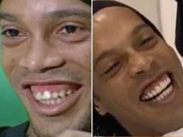 Dj naldinho, mc dia de maldade, mc kapela, mc kelvinho, mc magal, mc pp da vs e mc ryan sp). Compare Os Dentes Dos Famosos Antes E Depois Da Fama Fotos R7 Hoje Em Dia