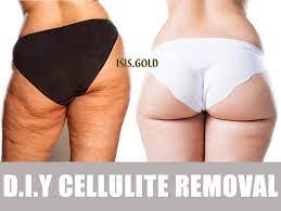 It is by far the easiest way to get rid of that unsightly dimples. How To Get Rid Of Cellulite On Thighs Buttocks Best Cellulite Treatment Best Skincare And Skin Bleaching Products