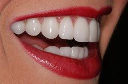 What kind of dental care does perfect smile offer? Pin On Teeth