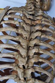 Human back bone chart back bones diagram human anatomy. Hd Wallpaper Bones Skeleton Spine Human Back Body Anatomy Medical Wallpaper Flare