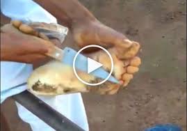 So entfernst du effektiv rissige hornhaut von den fußsohlen. Mann Schneidet Zentimeterdicke Hornhaut Ab Video Unsertirol24