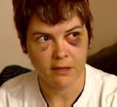 Attack against Edmonton lesbian not investigated by police until five days  later