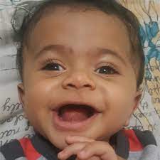 Baby With Water On The Brain Fights To Stay Alive Health24