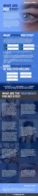 What Are Red Eyes Infographic Portal
