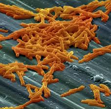 How listeria monocytogenes is transmitted. Bakterien Was Erreger Verursachen Konnen Bilder Fotos Welt