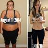 Possibly the answer is to lose weight in increments of, say, 20 pounds at a time, always allowing time for the skin to catch up prior to embarking on further weight loss. 1