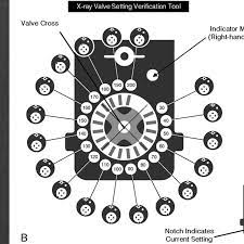 The codman hakim programmable valve (codman/johnson & johnson, raynham, massachusetts) permits regulation of the opening pressure between 30 and 200 mm h2o. A Radiographic Appearance Of The Codman Hakim Programmable Valve Set Download Scientific Diagram