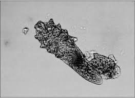 Image result for Demodex brevis