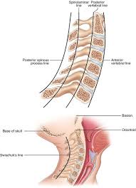 These nerves branch off in pairs from the spinal cord or the cauda equina at each spinal segment. Fractures Of The Spine In Children Springerlink
