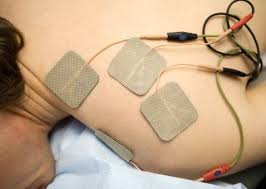 Image result for Electrical Stimulation Therapy