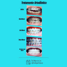 Profile for Oral Spartacus