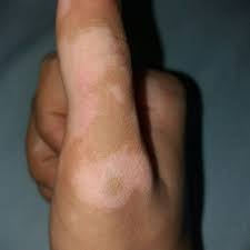 Maybe you would like to learn more about one of these? Ø¹ï»»Ø¬ Ø§Ù„Ø¨Ù‡Ø§Ù‚ ÙˆØ§Ù„ØµØ¯ÙÙŠÙ‡ Ø§Ù„Ù…Ù†Ø´ÙˆØ±Ø§Øª ÙÙŠØ³Ø¨ÙˆÙƒ