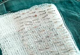 نتیجه جستجوی لغت [graft] در گوگل