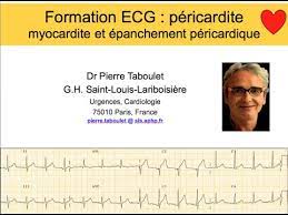 Pericarditis is inflammation of the pericardium (the fibrous sac surrounding the heart). 9a Pericardite Myocardite Epanchement Pericardique Formation Ecg Dr P Taboulet Youtube