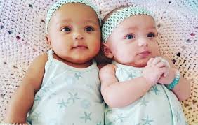 Mom Gives Birth To Twins Then She Notices They Don T Look Very Much Alike Biracial Twins Fraternal Twins Twins