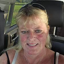 What happened in the accident