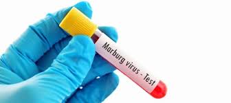 The virus is considered to be extremely dangerous. Febbre Emorragica Di Marburg Home Facebook