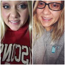 Same dress, one year apart, 35 pounds lighter