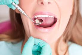 Top 10 Health Benefits of Regular Dental Checkups