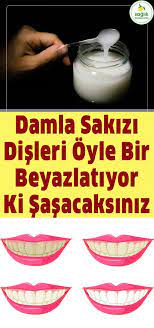 Damla Sakizi Disleri Bembeyaz Yapiyor Dis Beyazlatma Tartar Saglik Sifa Dogal Tedavi Nasil Yapilir Evde Yap Teeth Care Natural Medicine Natural Mask