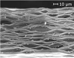 Ellis, starring jason statham, kim basinger, william h. A Cellular Polypropylene Cpp Films Have An Internal Structure With Download Scientific Diagram