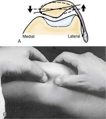Image result for Patella Mobility Test