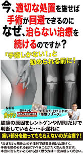 手術を勧められた膝の痛みを解消する方法 膝の痛み 痛み 膝