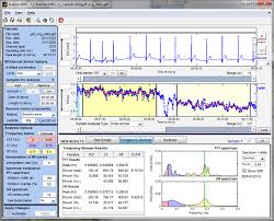 Biosignal Analysis And Medical Imaging Group Kubios Hrv Hrv Medical Imaging User Interface