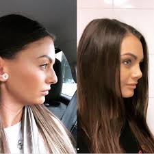 When it feels like you've been watching alex crash and burn with hopelessly unsuitable women since sometime before the start of the hundred years war, these are the moments when that vast debt is repaid. Love Island S Kendall Rae Knight Shows Off New Nose After Getting Secret Surgery In Turkey
