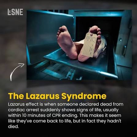 LeSNE(2209)....Lazarus syndrome is very rare. One 2015 case report found  that only 32 cases were reported between 1982 and 2008. . *Follow to Learn  Everyday* @learn_something_new_every_day_ @learn_something_new_every_day_  ...