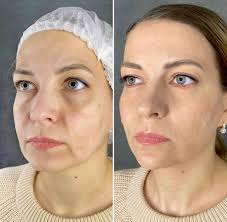 История торговой марки SachaJuan началась с создания в 1997 году в  Стокгольме сети салонов красоты. Основателями их стали парикмахеры-стилисты Sasha  Mitic и Juan Rosenlind, к тому времени уже зарекомендовавшие себя как  ведущие