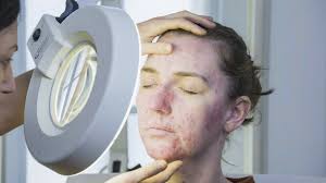 Watch The Bad Skin Clinic • Season 2 Full Episodes Online