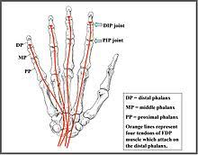 The anatomy of the flexor surface of the wrist is defined principally by the flexor retinaculum. Jersey Finger Wikipedia