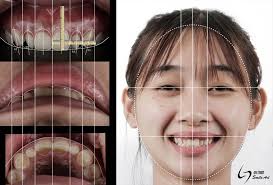 Mask-proof Smile Taipei, Taiwan