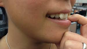 Hands are a hotbed for germs, and nails are their perfect hideout. Nail Biting Mental Disorder Or Just A Bad Habit Shots Health News Npr