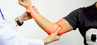 Ulnar nerve entrapment is the second most common compressive neuropathy after carpal tunnel syndrome. Orthopedic Treatment For Ulnar Nerve Entrapment Orthotexas